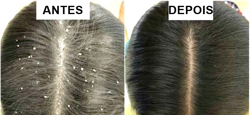 antes e depois nutro wash hair